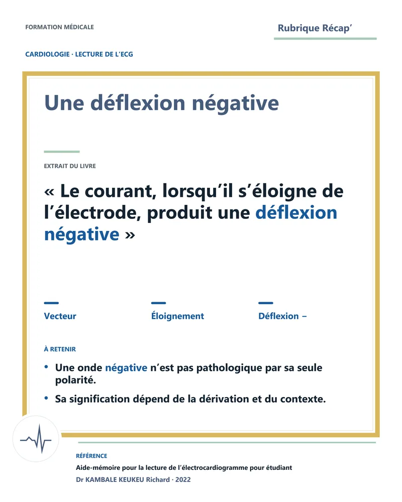 Une déflexion négative