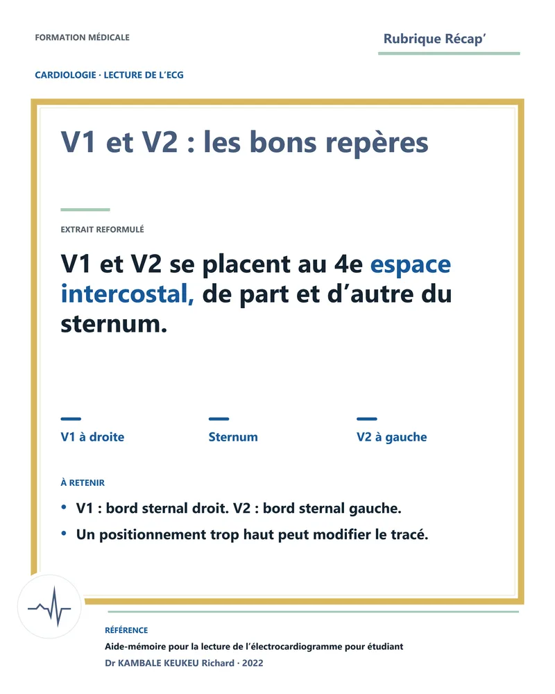 V1 et V2 : les bons repères