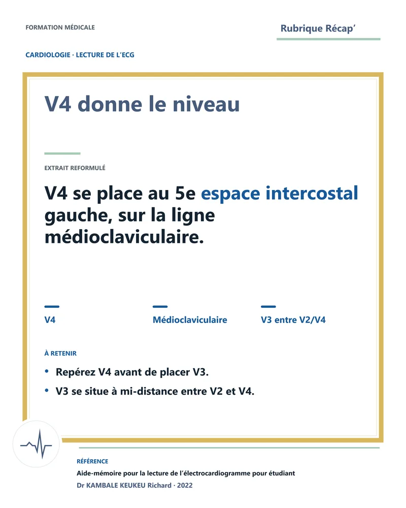 V4 donne le niveau