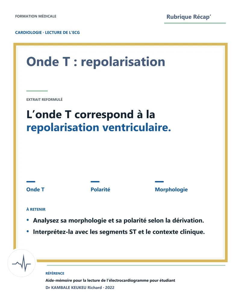 Onde T : repolarisation