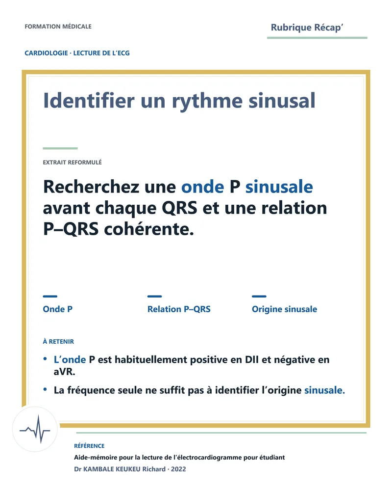 Identifier un rythme sinusal