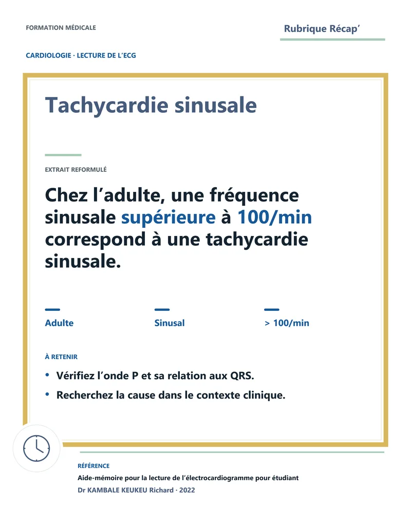 Tachycardie sinusale