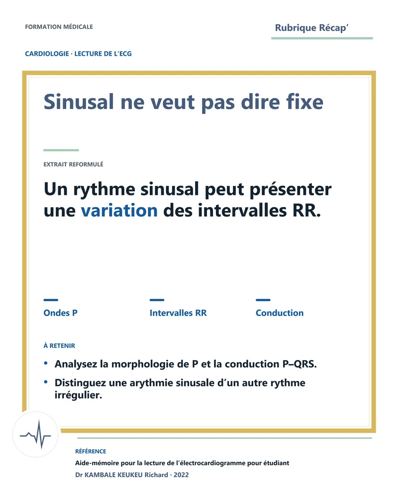 Sinusal ne veut pas dire fixe